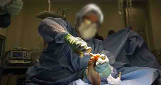 Great Toe Arthritis