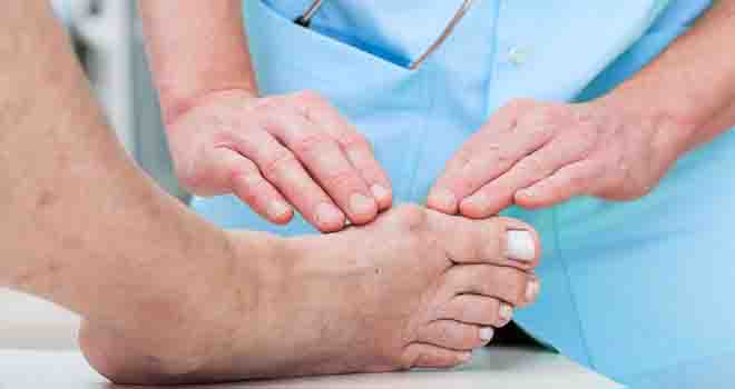 Bunion Surgery
