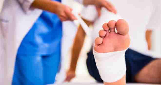Neuroma Excision