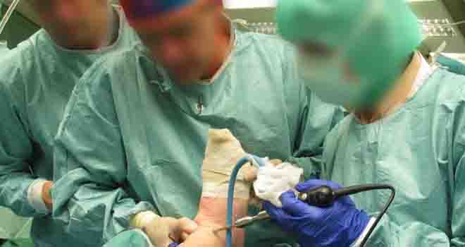 Hindfoot Endoscopy