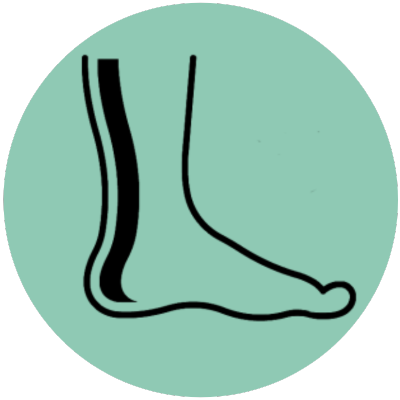 Achilles Tendon Repair