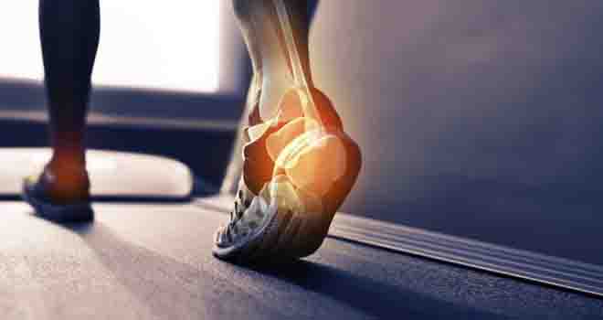 Ankle Impingement
